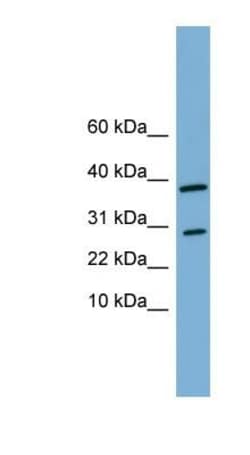 VNN3 Antibody, Novus Biologicals 100&mu;L; Unlabeled:Antibodies, Polyclonal