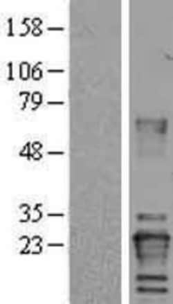 Novus Biologicals&trade;&nbsp;Von Hippel Lindau Overexpression Lysate