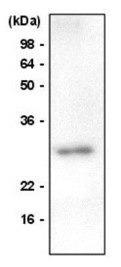Von Hippel Lindau Antibody (AT82B10) - BSA Free, Novus Biologicals 0.1mL;