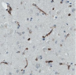 Von Willebrand Factor Antibody (CL1950), Novus Biologicals:Antibodies:Primary