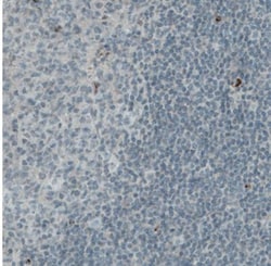 Von Willebrand Factor Antibody (CL1950), Novus Biologicals:Antibodies:Primary