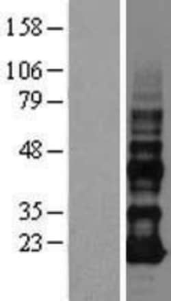 Novus Biologicals™ VOPP1 Overexpression Lysate