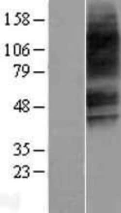 Novus Biologicals&trade;&nbsp;VIPR2/VPAC2 Overexpression Lysate