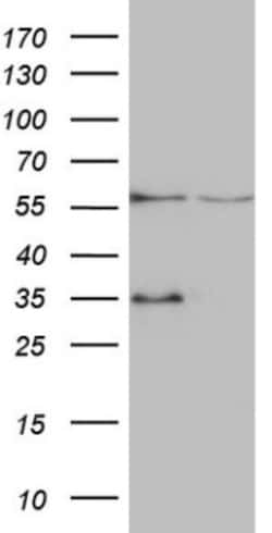 VPS13B Antibody (OTI6F6), Novus Biologicals 0.1mL; Unlabeled:Antibodies,