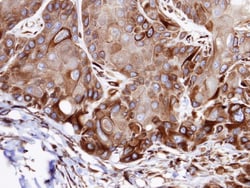 VPS16 Antibody, Novus Biologicals 0.1mL; Unlabeled:Antibodies, Polyclonal