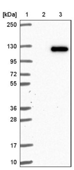 VPS18 Antibody, Novus Biologicals 25 &mu;L; Unlabeled:Antibodies, Polyclonal