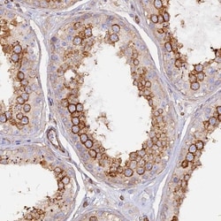 VPS18 Antibody, Novus Biologicals 25 &mu;L; Unlabeled:Antibodies, Polyclonal