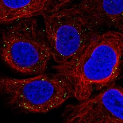 VPS26A Antibody (CL2287), Novus Biologicals 0.1mL; Unlabeled:Antibodies,