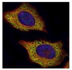 VPS28 Antibody, Novus Biologicals 0.1mL; Unlabeled:Antibodies, Polyclonal