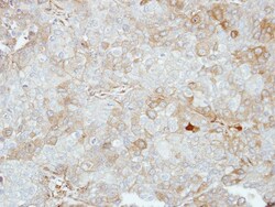 VPS28 Antibody, Novus Biologicals 0.1mL; Unlabeled:Antibodies, Polyclonal
