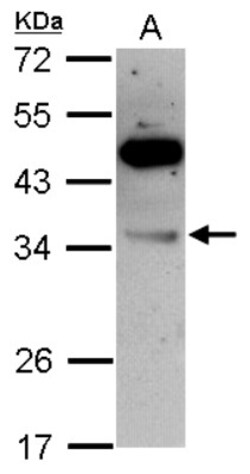 VPS28 Antibody, Novus Biologicals 0.1mL; Unlabeled:Antibodies, Polyclonal