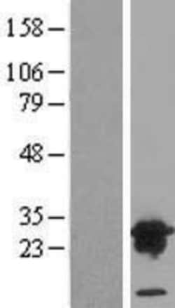 Novus Biologicals&trade;&nbsp;VPS28 Overexpression Lysate
