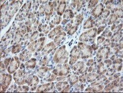 VPS28 Antibody (OTI1A8), Novus Biologicals 0.1mL; Unlabeled:Antibodies,