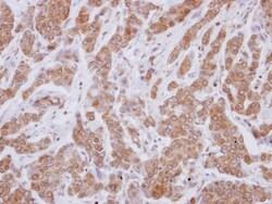VPS29 Antibody, Novus Biologicals 0.1mL; Unlabeled:Antibodies, Polyclonal