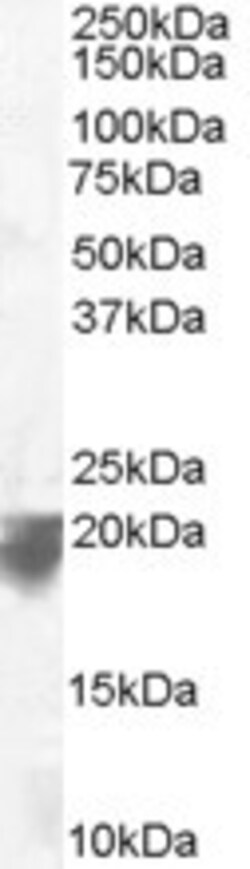 VPS29 Antibody, Novus Biologicals 0.1mg; Unlabeled:Antibodies, Polyclonal