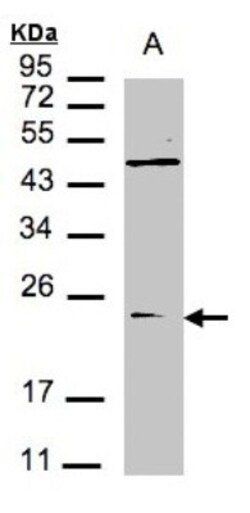VPS29 Antibody, Novus Biologicals 0.1mg; Unlabeled:Antibodies, Polyclonal