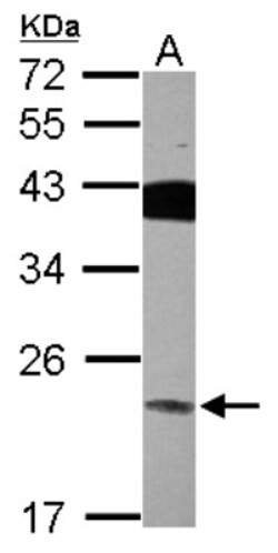 VPS29 Antibody, Novus Biologicals 0.1mL; Unlabeled:Antibodies, Polyclonal