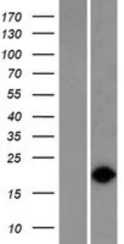 Novus Biologicals&trade;&nbsp;VPS29 Overexpression Lysate