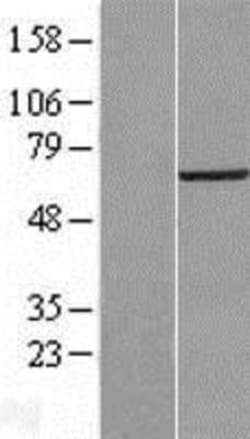 Novus Biologicals&trade;&nbsp;VPS33B Overexpression Lysate
