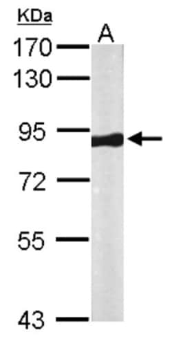 VPS35 Antibody, Novus Biologicals 0.1mL; Unlabeled:Antikroppar