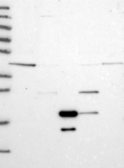 VPS36 Antibody, Novus Biologicals 0.1mL; Unlabeled:Antibodies, Polyclonal