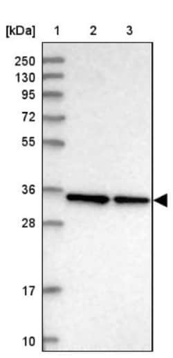 VPS37B Antibody, Novus Biologicals 0.1mL; Unlabeled:Antibodies, Polyclonal