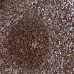 VPS37B Antibody, Novus Biologicals 0.1mL; Unlabeled:Antibodies, Polyclonal