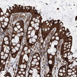 VPS37B Antibody, Novus Biologicals:Antibodies:Primary Antibodies
