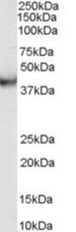 VPS37C Antibody, Novus Biologicals 0.1mg; Unlabeled:Antibodies, Polyclonal