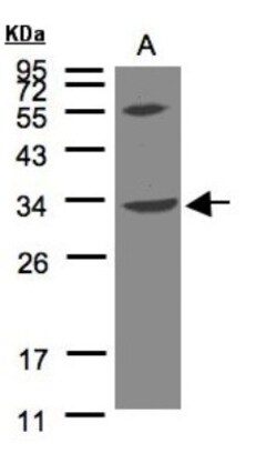 VPS37C Antibody, Novus Biologicals 0.1mg; Unlabeled:Antibodies, Polyclonal
