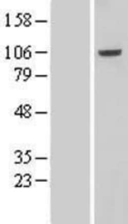 Novus Biologicals&trade;&nbsp;VPS41 Overexpression Lysate