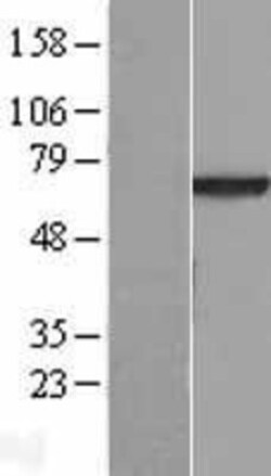 Novus Biologicals&trade;&nbsp;VPS45 Overexpression Lysate