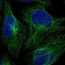 VPS45 Antibody, Novus Biologicals 0.1mL; Unlabeled:Antibodies, Polyclonal