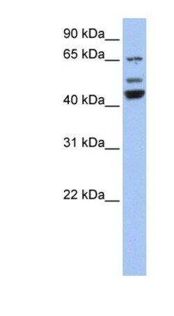 VPS4A Antibody, Novus Biologicals:Antibodies:Primary Antibodies