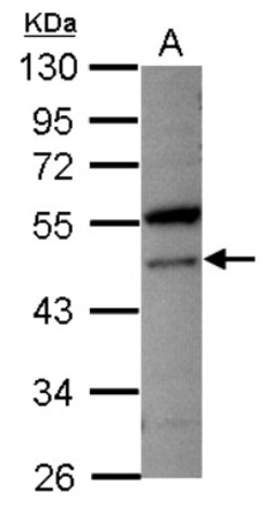VPS4A Antibody, Novus Biologicals 0.1mL; Unlabeled:Antibodies, Polyclonal