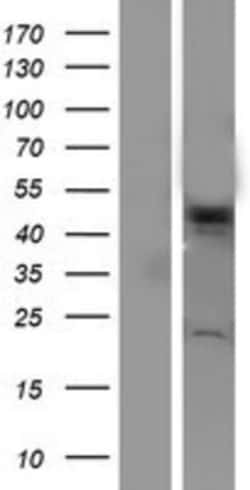 Novus Biologicals&trade;&nbsp;VPS4A Overexpression Lysate