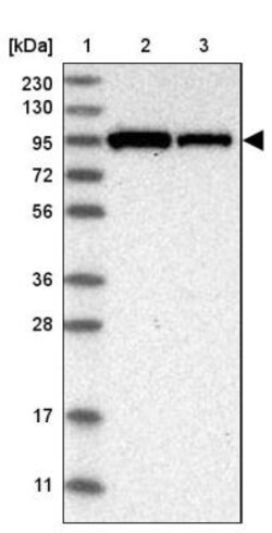 VPS53 Antibody, Novus Biologicals 25 &mu;L | Buy Online | Novus Biologicals | Fisher Scientific