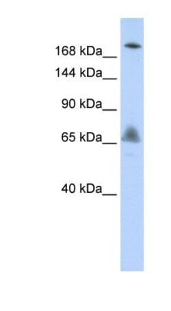 VPS8 Antibody, Novus Biologicals 0.05mg; Unlabeled:Antibodies, Polyclonal