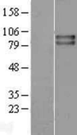 Novus Biologicals™ VRL1 Overexpression Lysate