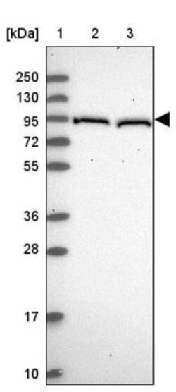 VRL1 Antibody, Novus Biologicals:Antibodies:Primary Antibodies