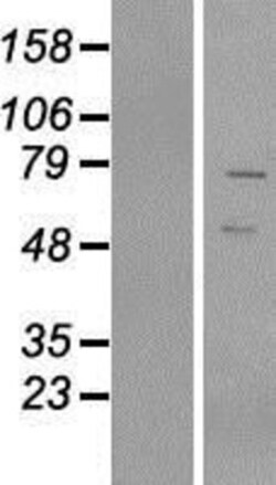 Novus Biologicals&trade;&nbsp;VRTN Overexpression Lysate