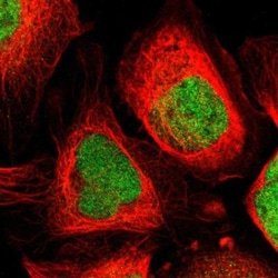 VRTN Antibody, Novus Biologicals 25 &mu;L; Unlabeled:Antibodies, Polyclonal