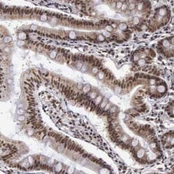 VRTN Antibody, Novus Biologicals 25 &mu;L; Unlabeled:Antibodies, Polyclonal