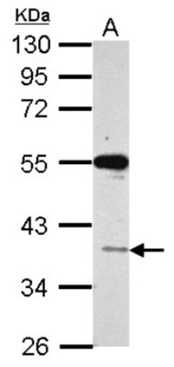 VSIG1 Antibody, Novus Biologicals 0.1mL; Unlabeled:Antibodies, Polyclonal