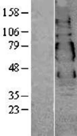 Novus Biologicals&trade;&nbsp;VSIG1 Overexpression Lysate
