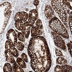 VSIG1 Antibody, Novus Biologicals 0.1mL; Unlabeled:Antibodies, Polyclonal