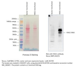 Novus Biologicals VSIG1 Overexpression Lysate 0.1 mg | Buy Online | Novus Biologicals&trade; | Fisher Scientific