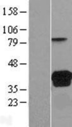 Novus Biologicals™ VSIG2 Overexpression Lysate