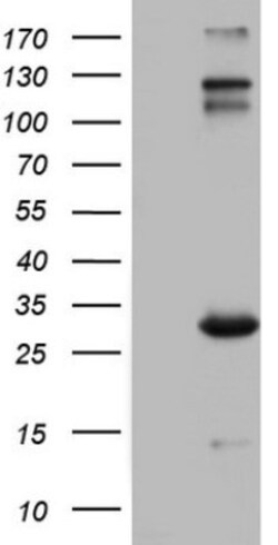 VSIG3/IGSF11 Antibody (OTI2H1), Novus Biologicals 0.1mL; Unlabeled:Antibodies,