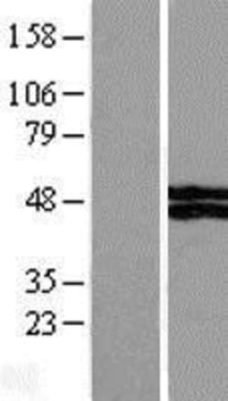 Novus Biologicals&trade;&nbsp;VSIG4 Overexpression Lysate